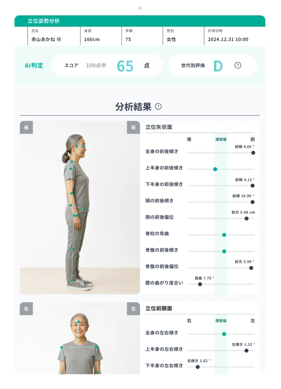 AI姿勢分析アプリ「ePose」