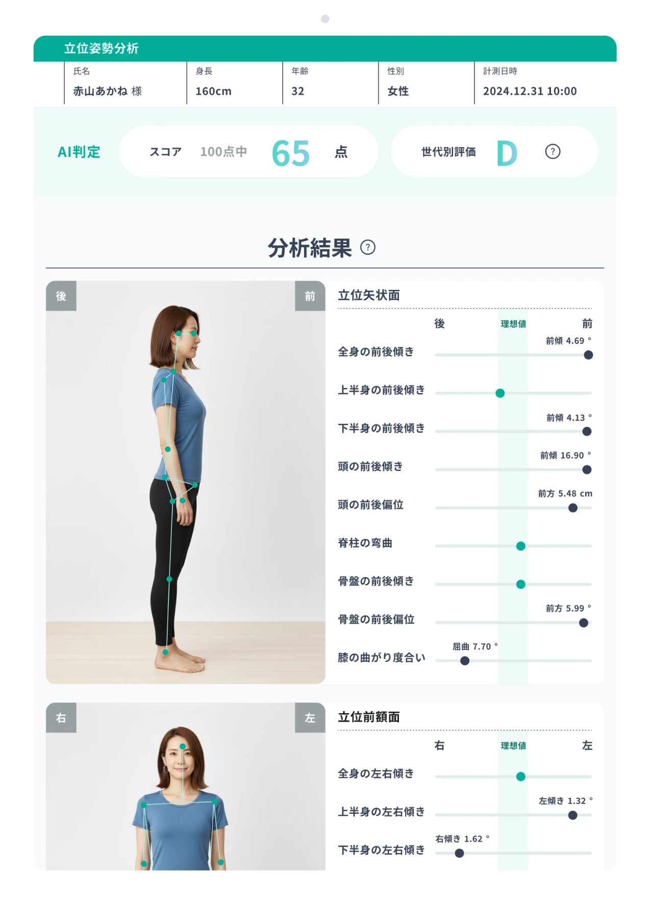 AI姿勢分析アプリ「ePose」