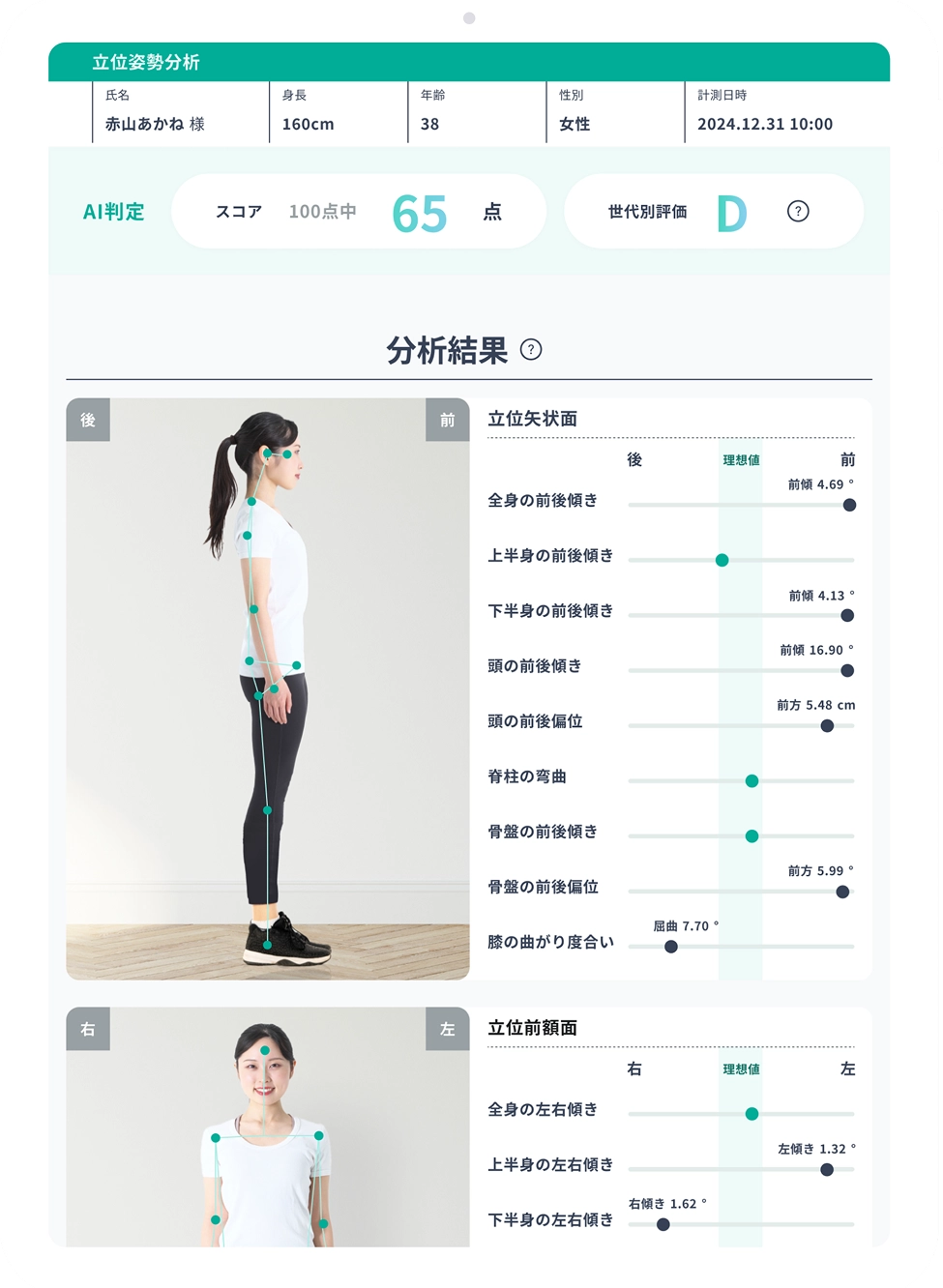 AI姿勢分析アプリ「ePose」