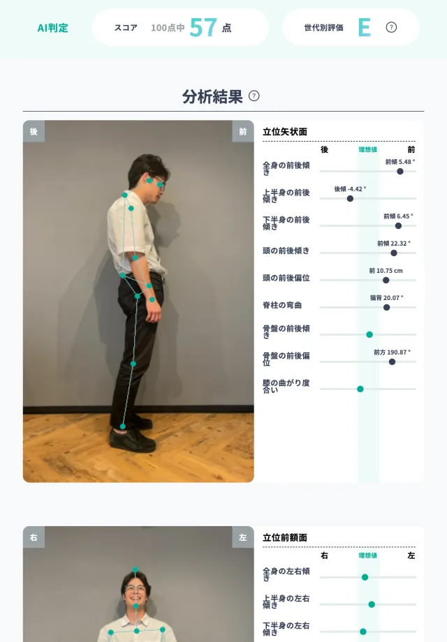 AI姿勢分析アプリePoseで分析した猫背＋スウェイバック姿勢のデータ