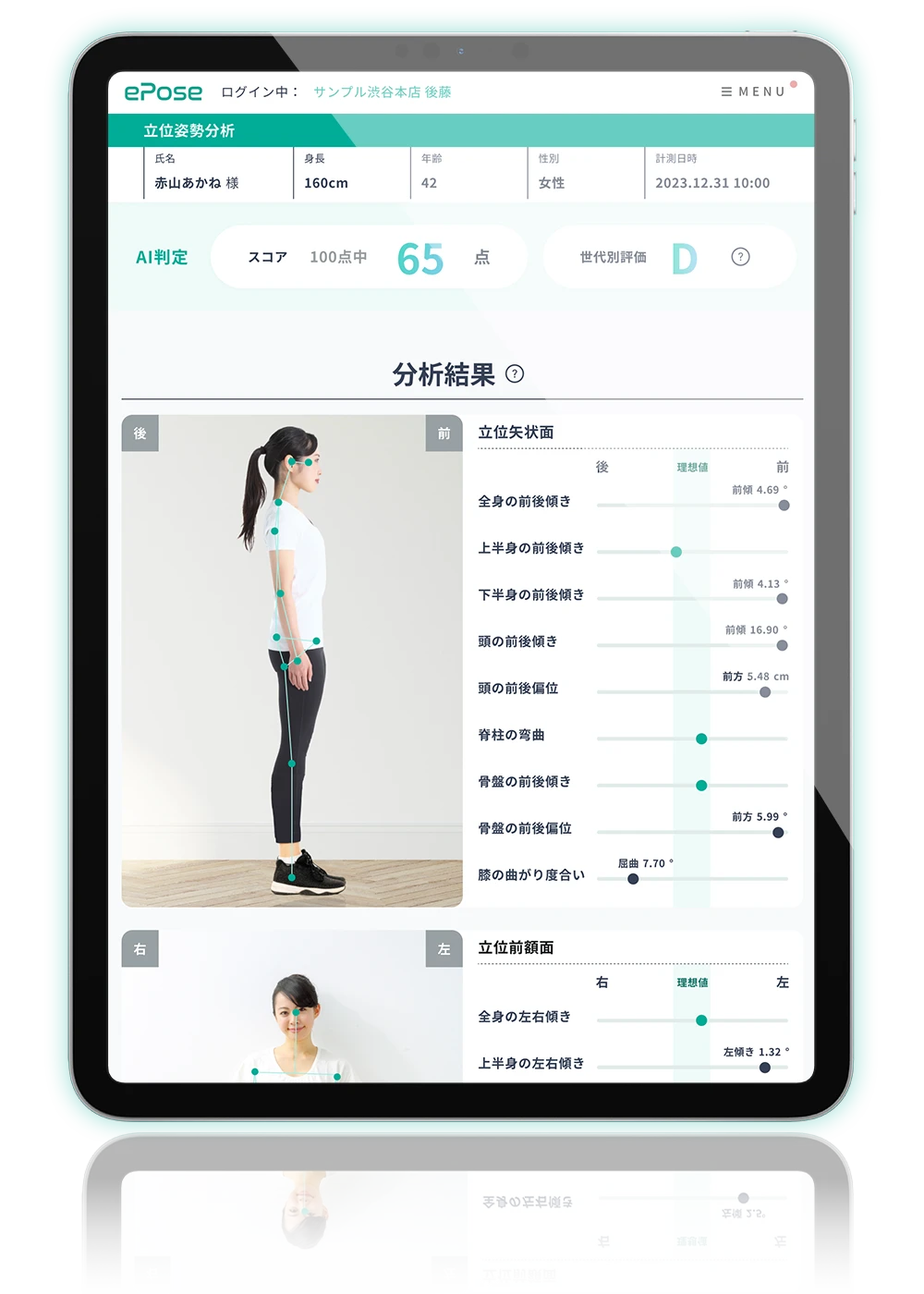 AI姿勢分析アプリ「ePose」